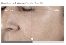 Load image into Gallery viewer, DrFreund Skincare Anti-Aging/Antioxidant SkinMedica HA5® Rejuvenating Hydrator
