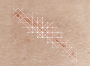 DrFreund Skincare scar treatments Biocorneum® Advanced Scar Treatment with Silishield Patented Crosslinking Silicone with SPF30 Sunscreen Biocorneum Advanced Scar Treatment with SPF 30 Sunscreen