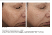 Load image into Gallery viewer, DrFreund Skincare skin brighteners/pigment correction SkinMedica Lytera 2.0 Pigment Correcting Serum SkinMedica® Lytera® 2.0 Pigment Correcting Serum |Non-Hydroquinone Rx
