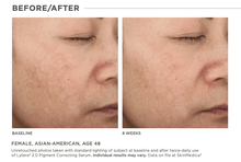 Load image into Gallery viewer, DrFreund Skincare skin brighteners/pigment correction SkinMedica Lytera 2.0 Pigment Correcting Serum SkinMedica® Lytera® 2.0 Pigment Correcting Serum |Non-Hydroquinone Rx
