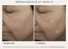 Load image into Gallery viewer, DrFreund Skincare SkinMedica TNS Advanced+Serum anti-aging serum, skincare, wrinkle and fine line corrector
