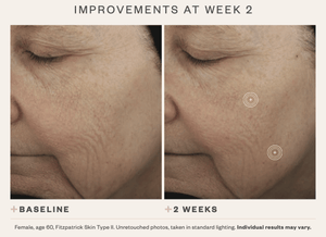 DrFreund Skincare SkinMedica TNS Advanced+Serum anti-aging serum, skincare, wrinkle and fine line corrector